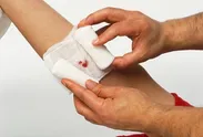 اینفوگرافی| پانسمان زخم با حداقل وسایل